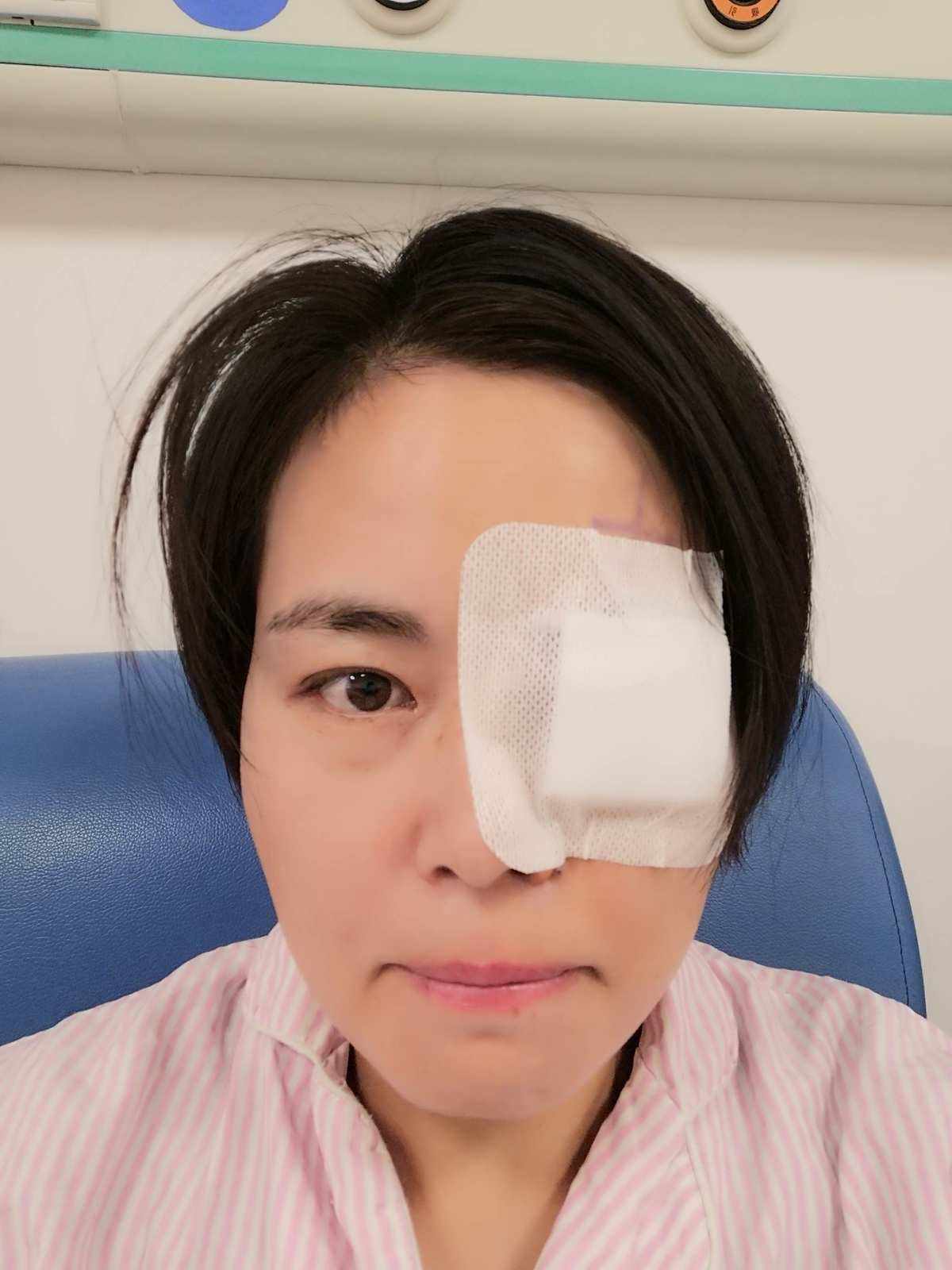 术后(术后疤痕修复用什么方法好)